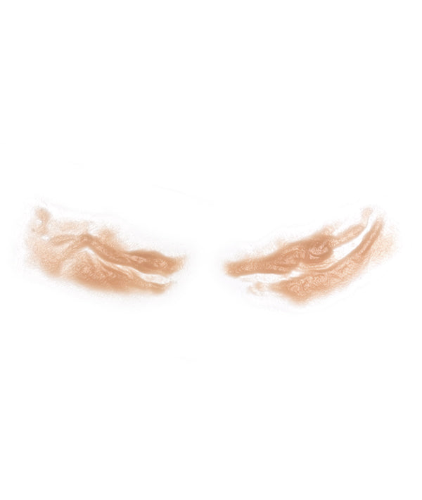 Cheek Scars