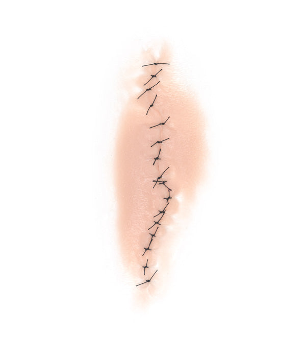 Dynamic Sutured Wound 1