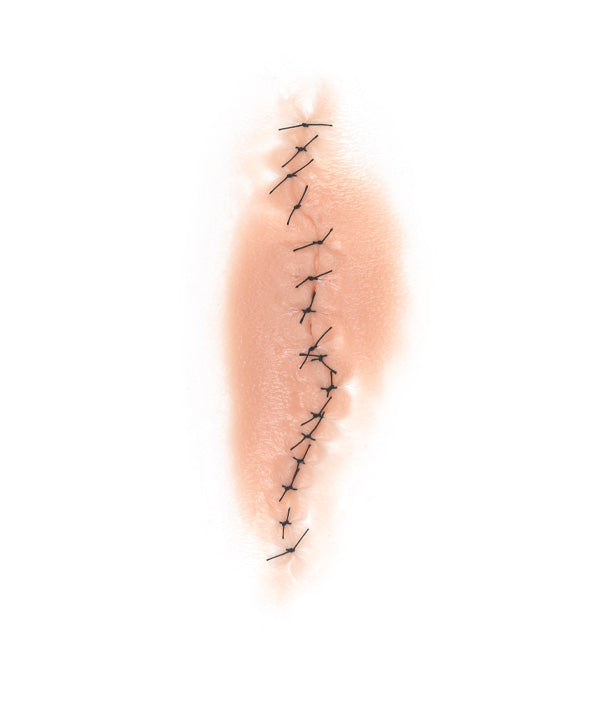 Dynamic Sutured Wound 1