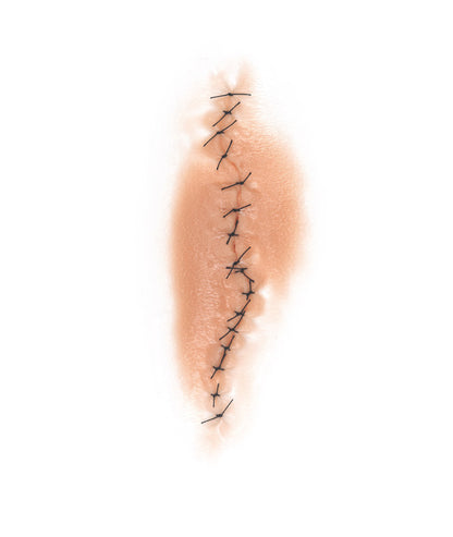 Dynamic Sutured Wound 1