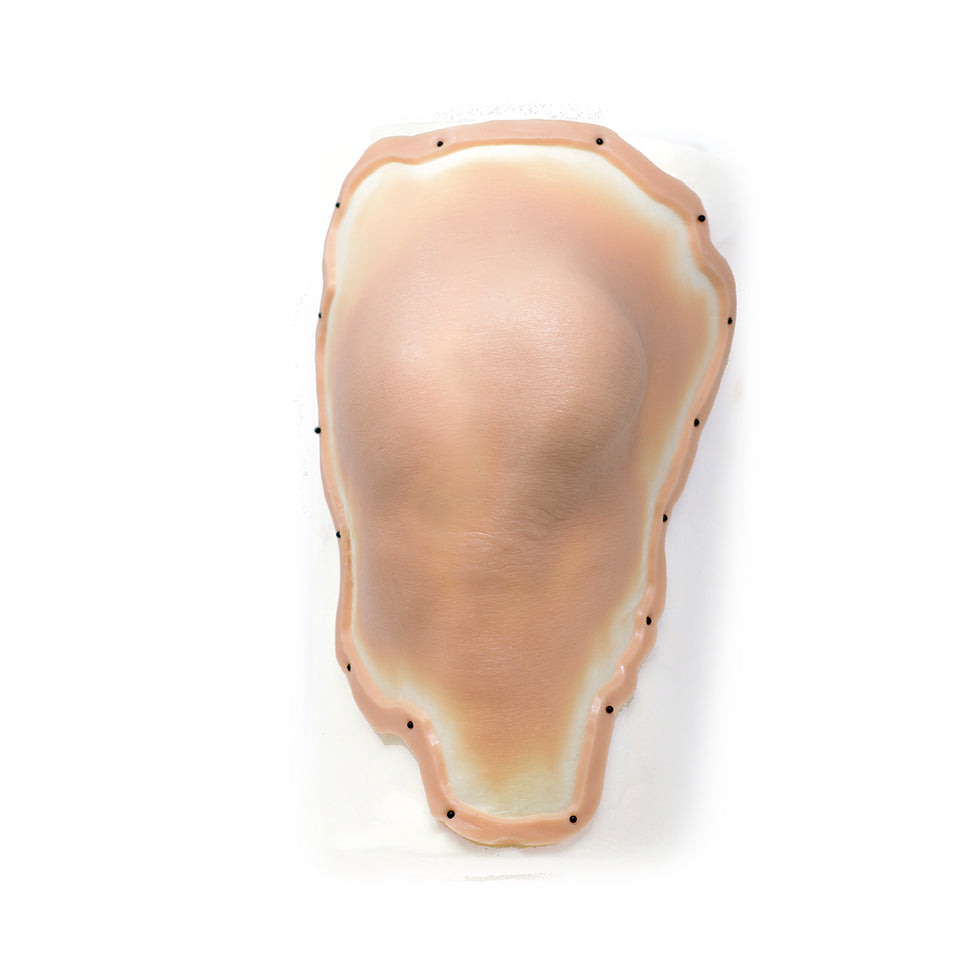 Dislocated Male Left Leg