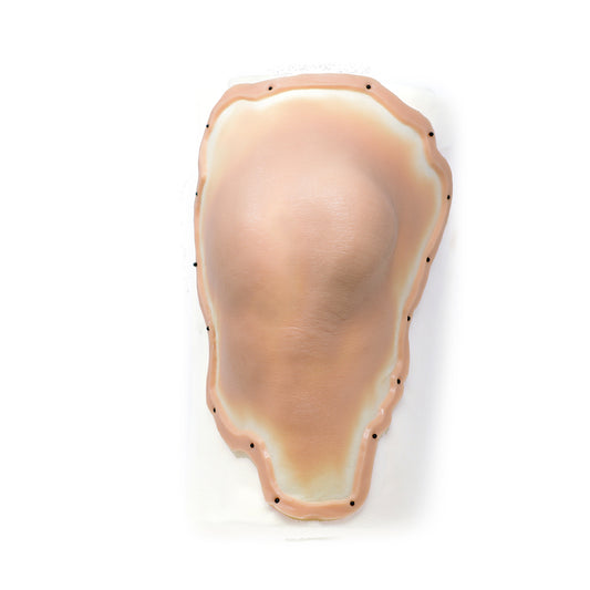 Dislocated Male Left Leg