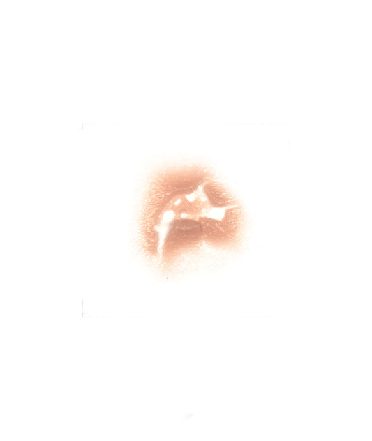 Tear 10