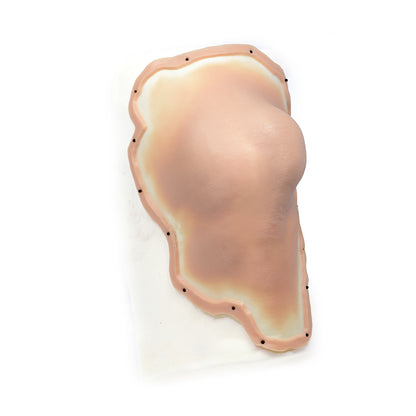 Dislocated Male Left Leg