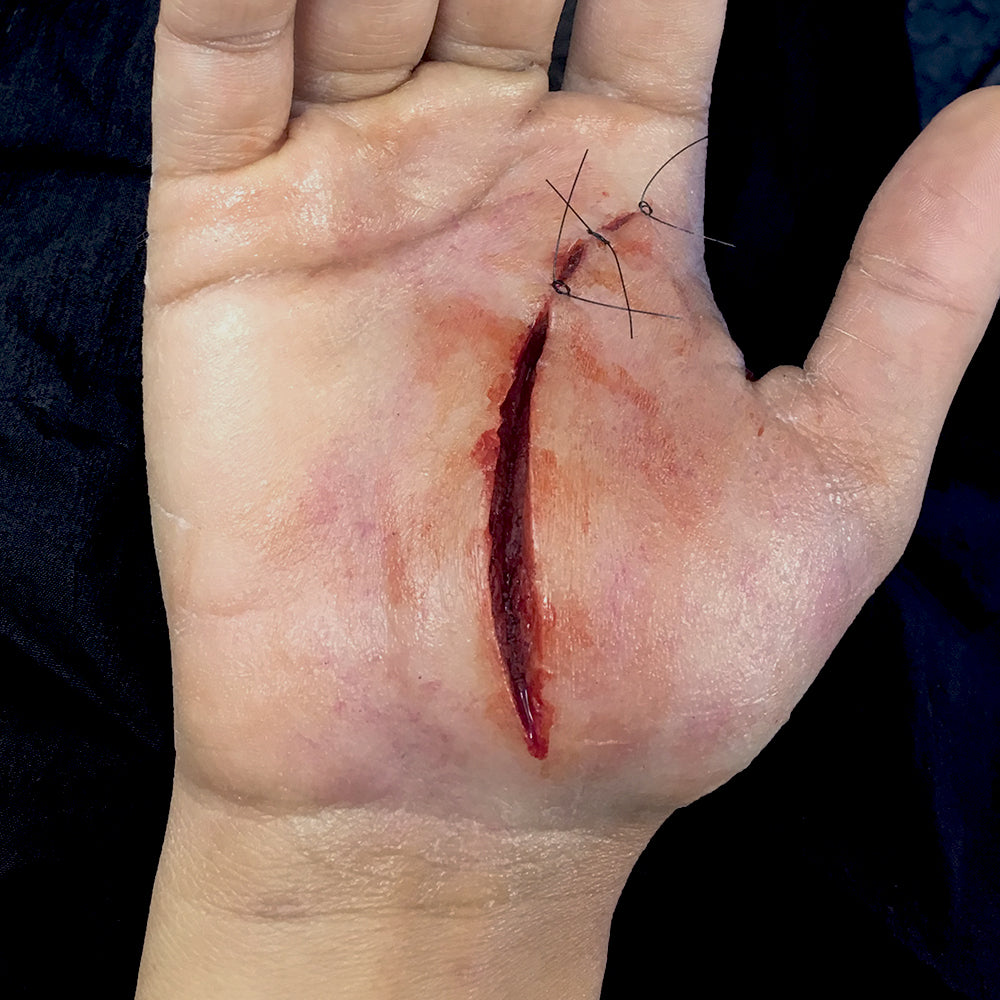 Palm stitchable wound