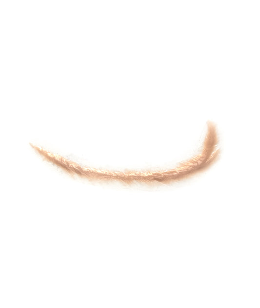 Curved Keloid Scar 2