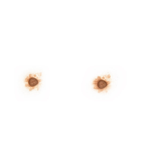Male Nipples