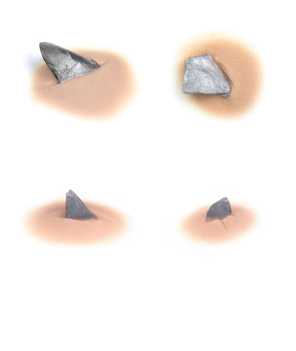 Shrapnel Torso Shrapnel Wound Kit 1 – Out of Kit