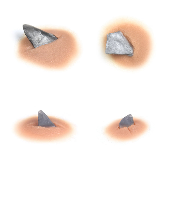 How To Remove Shrapnel From A Wound at Donna Bull blog